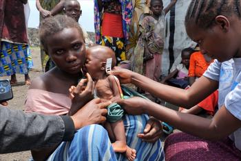 A malnourished child in the eastern DR Congo receives attention from a health worker.