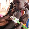 A malnourished child is assessed at a nutrition clinic in Fangak county, South Sudan.